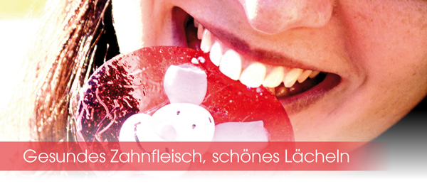 Zahnfleischbluten (Gingivitis), Parodontitis