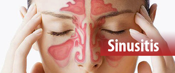 Sinusitis - integrative Heilmöglichkeiten für Nasennebenhöhlenentzündung