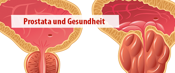 Unterstützung für die Gesundheit der Prostata