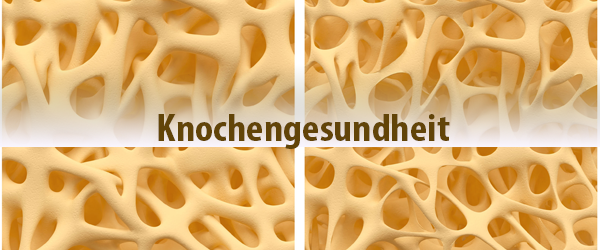 Osteoporose-wie man die Knochengesundheit stärken kann